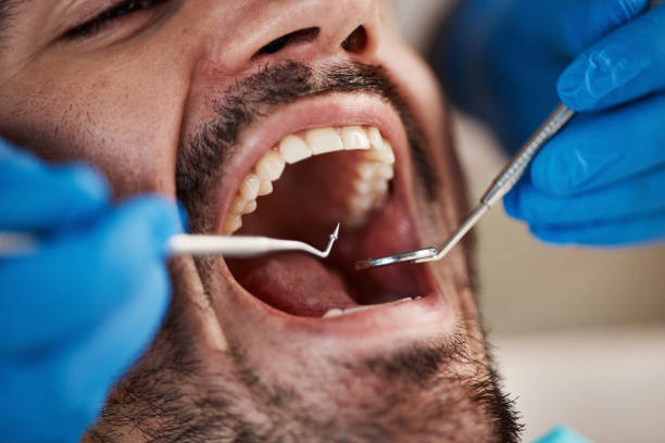 Best Emergency Dental Care for Trauma or Injury in Carrington, ND
