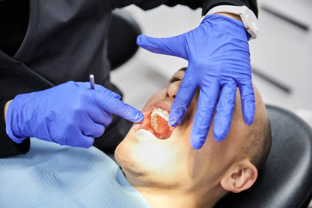 Best Emergency Broken Tooth Repair in Carrington, ND