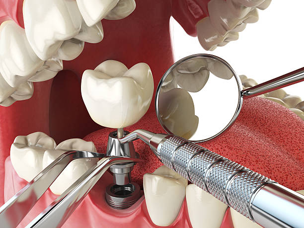 Fast & Reliable Emergency Dental Services in ND